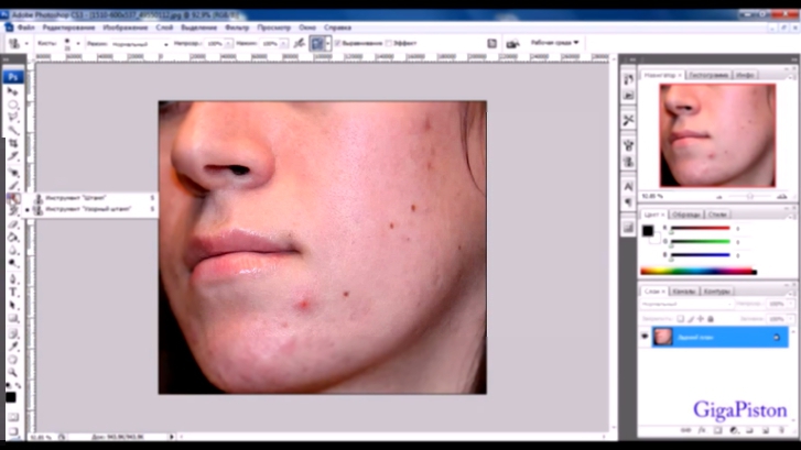 Как убрать прыщи в фотошопе 
